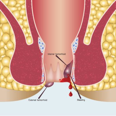 untitled design (23)